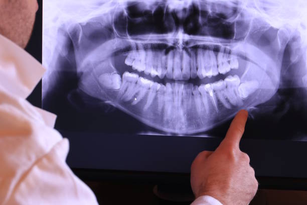Best Emergency Treatment for Dental Infections or Abscesses in Fort Hunt, VA