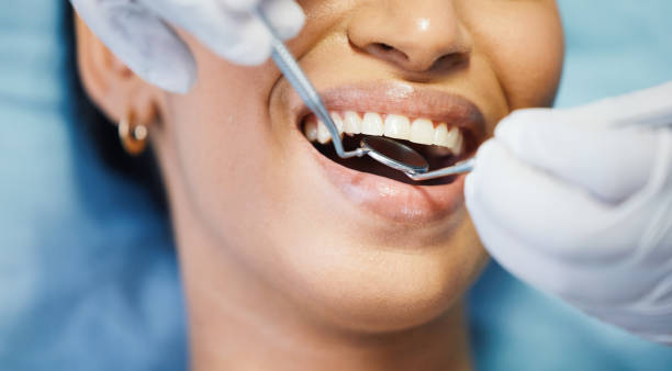 Best Emergency Dental Care for Broken or Chipped Teeth in Fort Hunt, VA